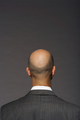 Bald Hair Loss home remedies