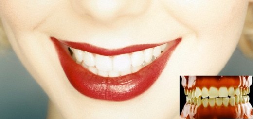 yellow to white teeth