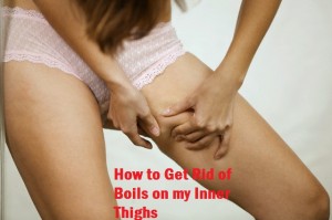 Inner Thighs Boils home remedies