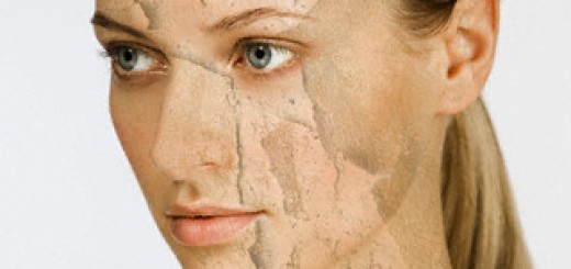 peeling skin home remedies