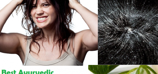 Ayurveda treatment for dandruff