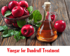 vinegar for dandruff