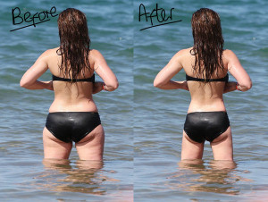 Weight Loss Before After Pics