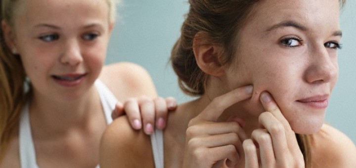 Dry Skin Acne Treatment Tips