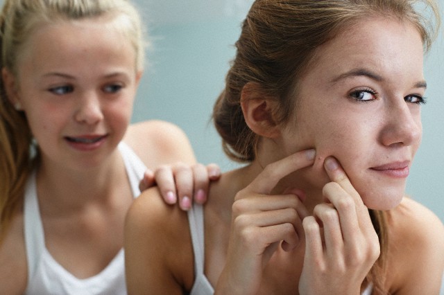 Dry Skin Acne Treatment Tips