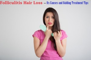 Folliculitis Hair Loss Treatment