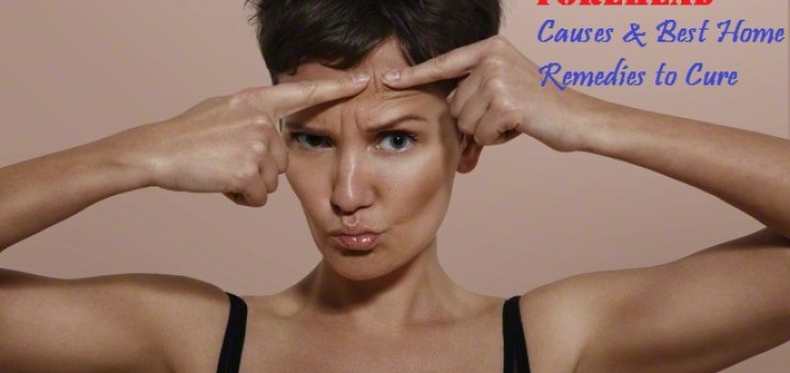 Forehead Pimples Causes Cure