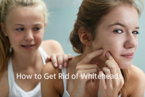 Ways to Treat Whiteheads