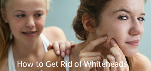 Ways to Treat Whiteheads