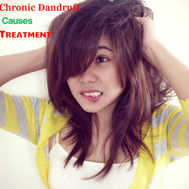 Chronic Dandruff Causes Cure