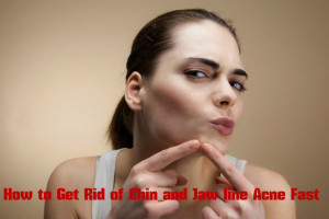 Chin Jawline Acne Tips