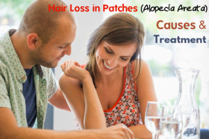Hair Loss in Patches