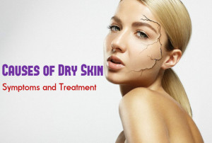 Dry Skin Causes Symptoms Treatment