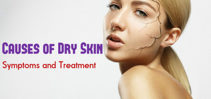 Dry Skin Causes Symptoms Treatment