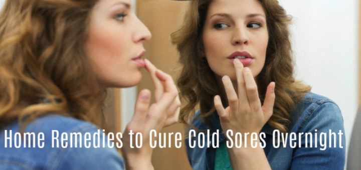 How Cure Cold Sores