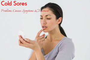 Cold Sores Causes Symptoms Treatment