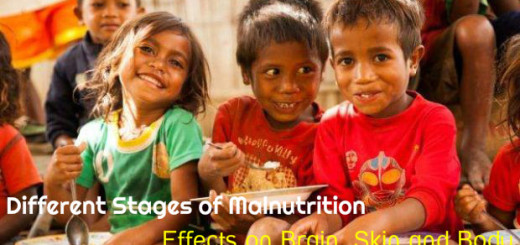 Malnutrition Stages Effects Body