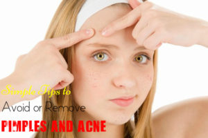 Avoid Remove Pimples Acne