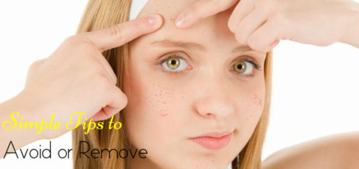 Avoid Remove Pimples Acne