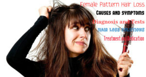 Female Pattern Hair Loss