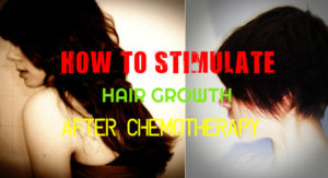 Hair Growth after Chemotherapy