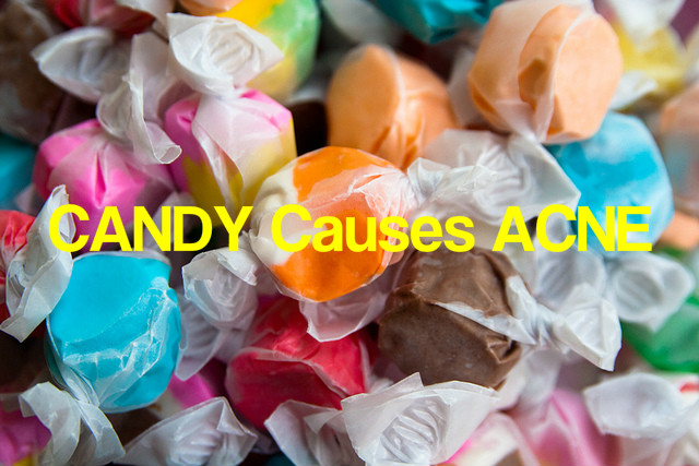 Candy Causes Acne