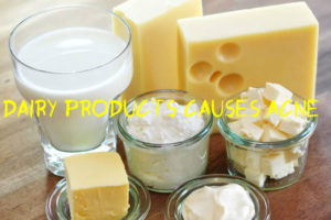 Dairy Products Causes Acne