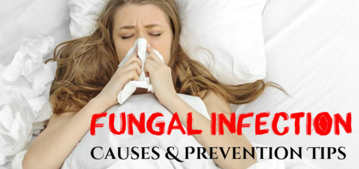 Fungal Infection Causes Prevention Tips