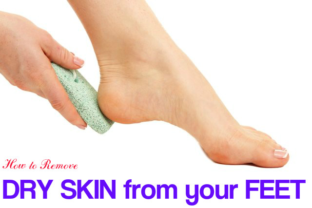 Remove Dry Skin from Feet