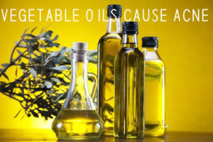 Vegetable Oils Cause Acne