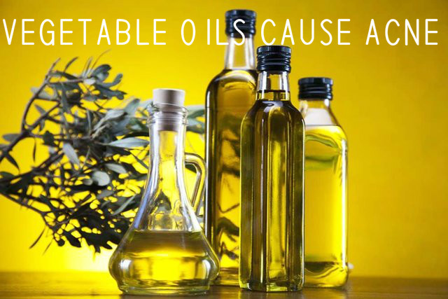 Vegetable Oils Cause Acne