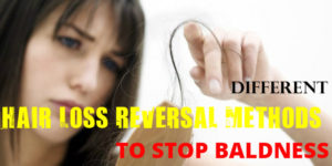 Hair Loss Reversal Methods