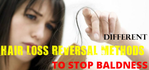 Hair Loss Reversal Methods