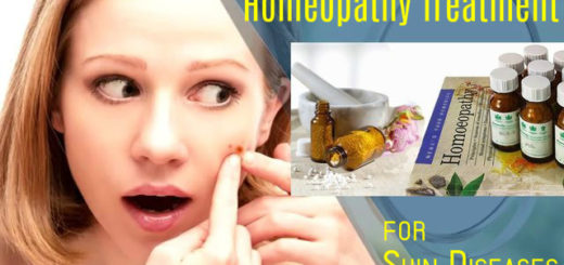 Homeopathy Treatment for Skin Diseases
