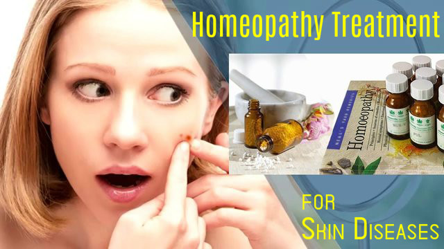 Homeopathy Treatment for Skin Diseases