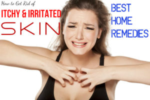 Itchy Irritated Skin Home Remedies