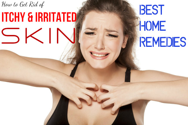 Itchy Irritated Skin Home Remedies