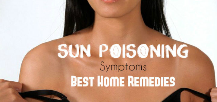Sun Poisoning Symptoms Remedies