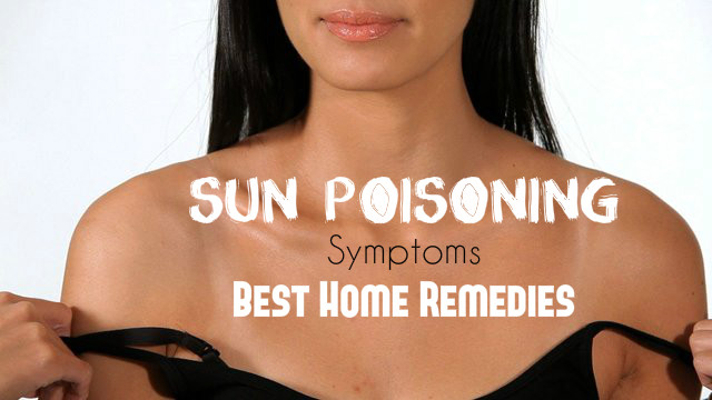 Sun Poisoning Symptoms Remedies