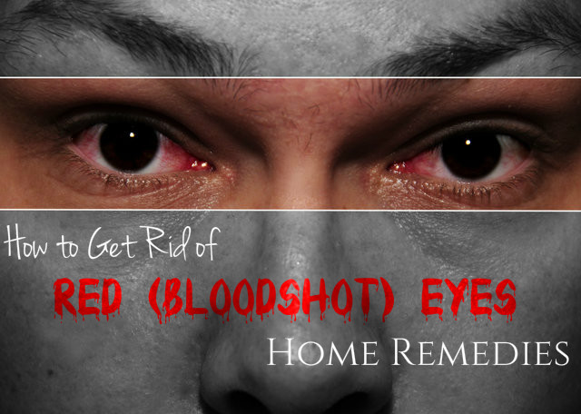 Red Eyes Home Remedies