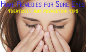 Sore Eyes Home Remedies