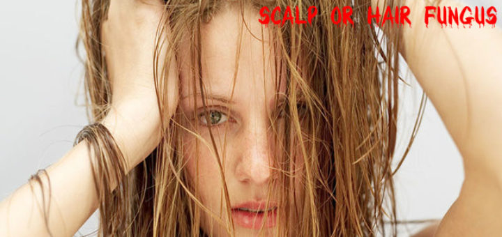 Scalp or Hair Fungus