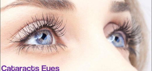 Cataracts Eyes - Home Remedies