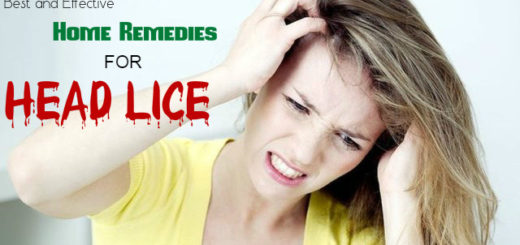 Home Remedies for Head Lice