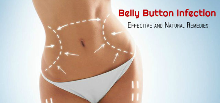 Belly Button Infection Treatment