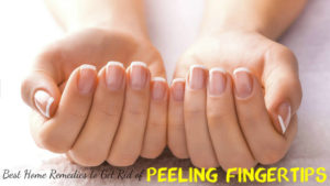 Peeling Fingertips