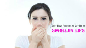 Swollen Lips Treatment