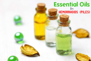 Essential Oils for Hemorrhoids