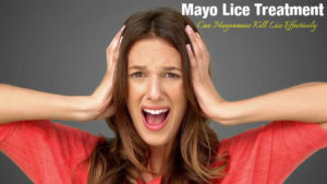 Mayo Lice Treatment