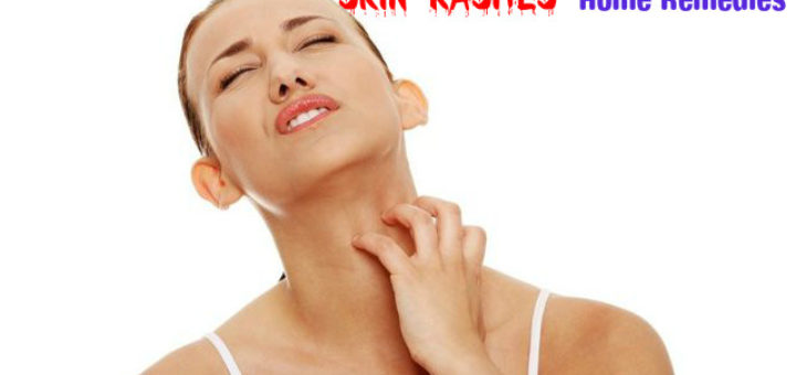 Skin Rashes Home Remedies